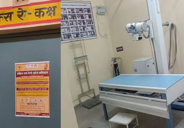 एक्स-रे टेक्नीशियन भर्ती घोटाले की जांच शुरू, रिकवरी…
